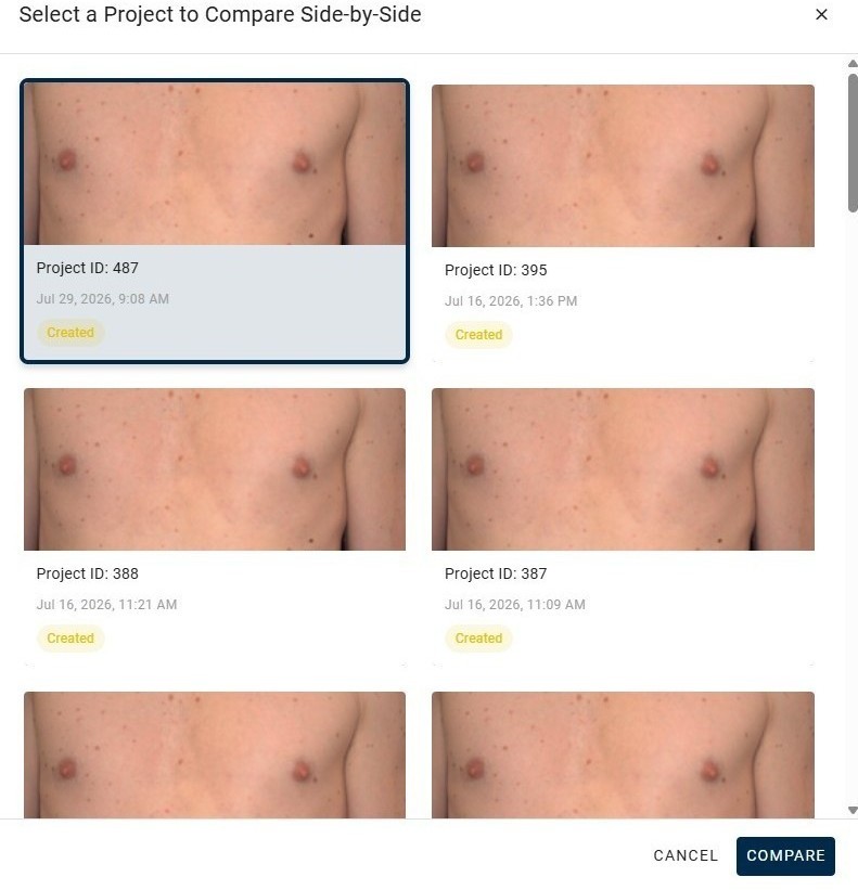 Select Comparison